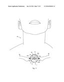 EMERGENCY TRACHEOTOMY DEVICE diagram and image