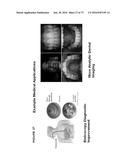 SENSOR-SYNCHRONIZED SPECTRALLY-STRUCTURED-LIGHT IMAGING diagram and image