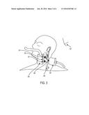 OPTO-ACOUSTIC IMAGING SYSTEM WITH DETECTION OF RELATIVE ORIENTATION OF     LIGHT SOURCE AND ACOUSTIC RECEIVER USING ACOUSTIC WAVES diagram and image