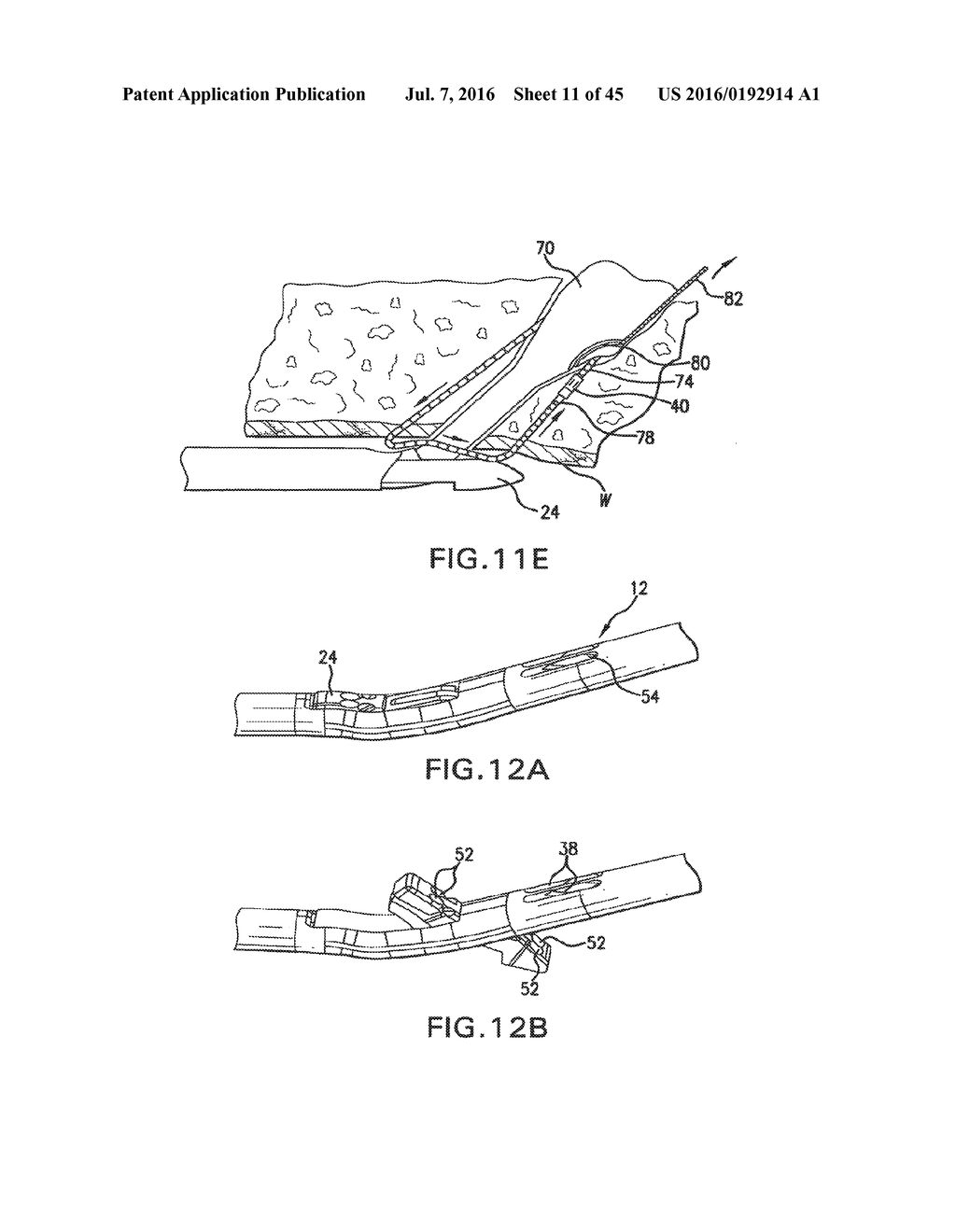 ARTICULATING SUTURING DEVICE AND METHOD - diagram, schematic, and image 12