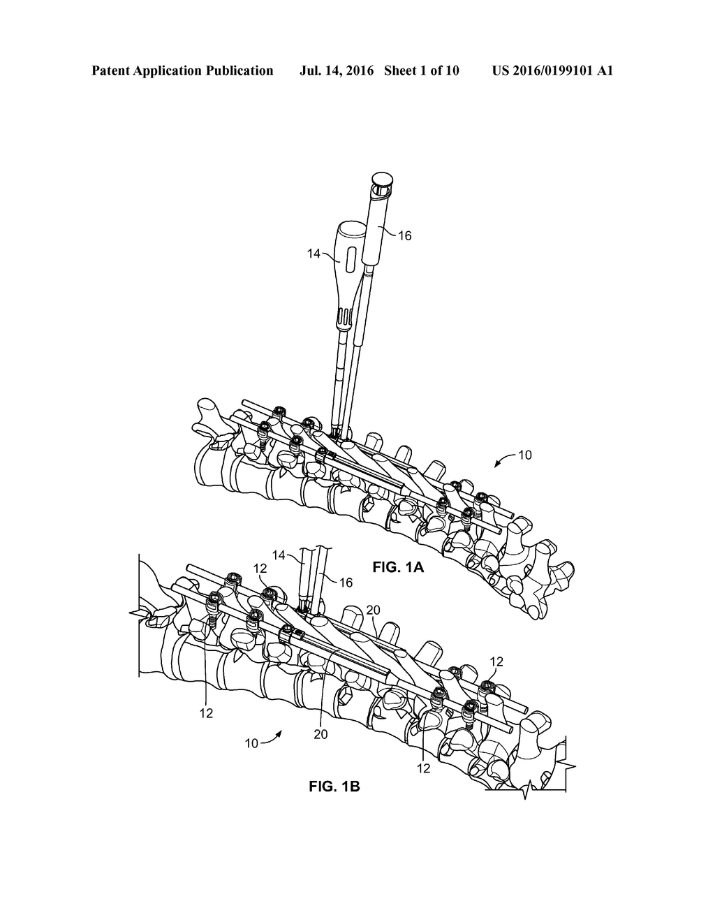 GROWING RODS AND METHODS OF USE - diagram, schematic, and image 02