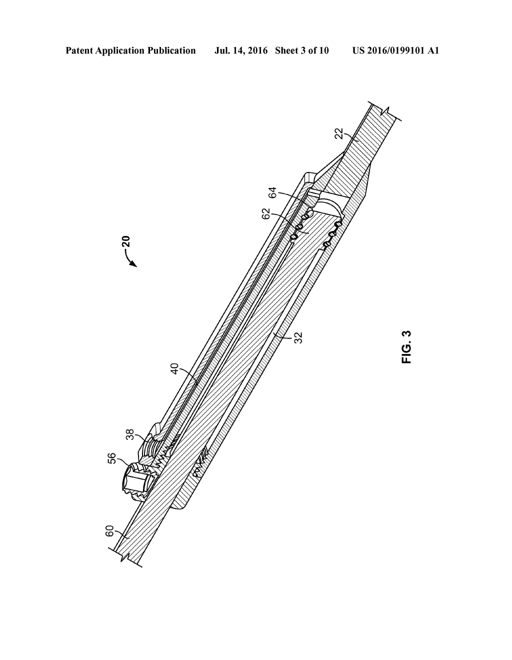 GROWING RODS AND METHODS OF USE - diagram, schematic, and image 04