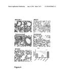 IMMUNOGENIC FORMULATION CONTAINING RECOMBINANT LIVE BCG THAT EXPRESS     ANTIGENS OF METAPNEUMOVIRUS (HMPV), IN A SUSPENSION PREPARED FROM A     LYOPHILISATE, WITHOUT REQUIRING AN ADJUVANT, SUITABLE FOR PHARMACEUTICAL     USE diagram and image