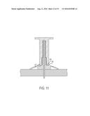 CONCRETE ANCHOR diagram and image