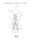 STALK SENSOR APPARATUS, SYSTEMS, AND METHODS diagram and image