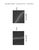 Multifunctional Degradable Nanoparticles with Control over Size and     Functionalities diagram and image