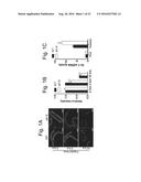 MARKERS FOR LIPID METABOLISM diagram and image