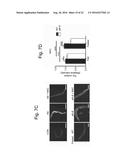 MARKERS FOR LIPID METABOLISM diagram and image