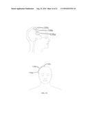 ELECTRICAL STIMULATION DEVICE AND METHOD FOR THE TREATMENT OF NEUROLOGICAL     DISORDERS diagram and image