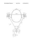 HEARING DEVICE FOR BINAURAL SUPPLY AND METHOD FOR ITS OPERATION diagram and image