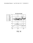 SYSTEM AND METHOD FOR IMPROVING HEARING diagram and image