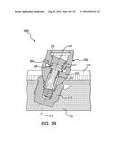 PROSTHESIS ADAPTER diagram and image