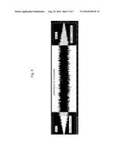 HEARING INSTRUMENT diagram and image