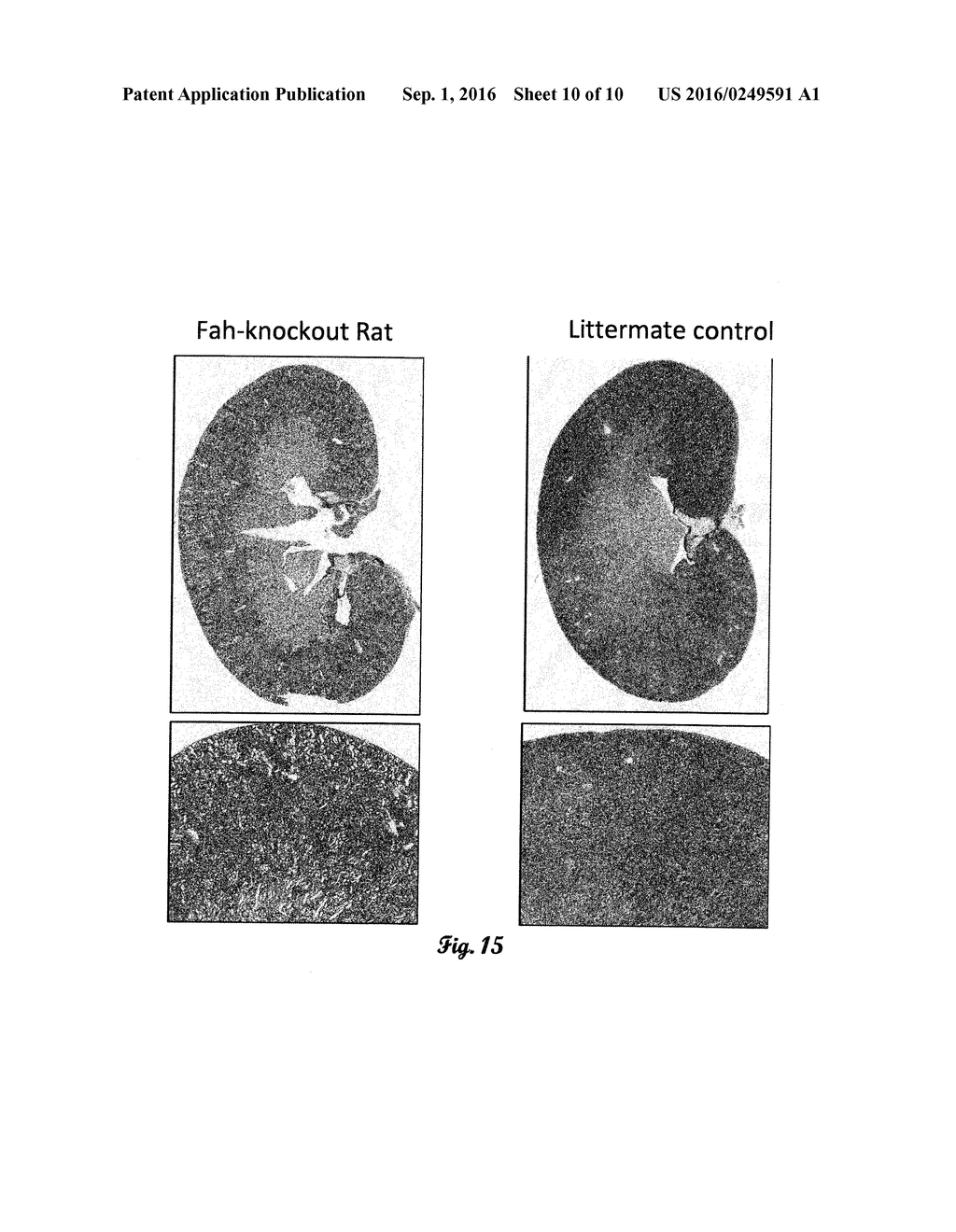 FUMARYLACETOACETATE HYDROLASE (FAH)-DEFICIENT AND IMMUNODEFICIENT RATS AND     USES THEREOF - diagram, schematic, and image 11