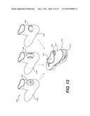 Method Including Footwear And Sock Having Aligning Indicia diagram and image