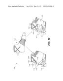 Method Including Footwear And Sock Having Aligning Indicia diagram and image