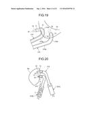 TREATMENT METHOD diagram and image