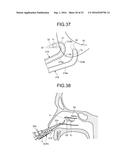 TREATMENT METHOD diagram and image