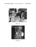 SELF-ILLUMINATED HANDHELD LENS FOR RETINAL EXAMINATION AND PHOTOGRAPHY AND     RELATED METHOD THEREOF diagram and image