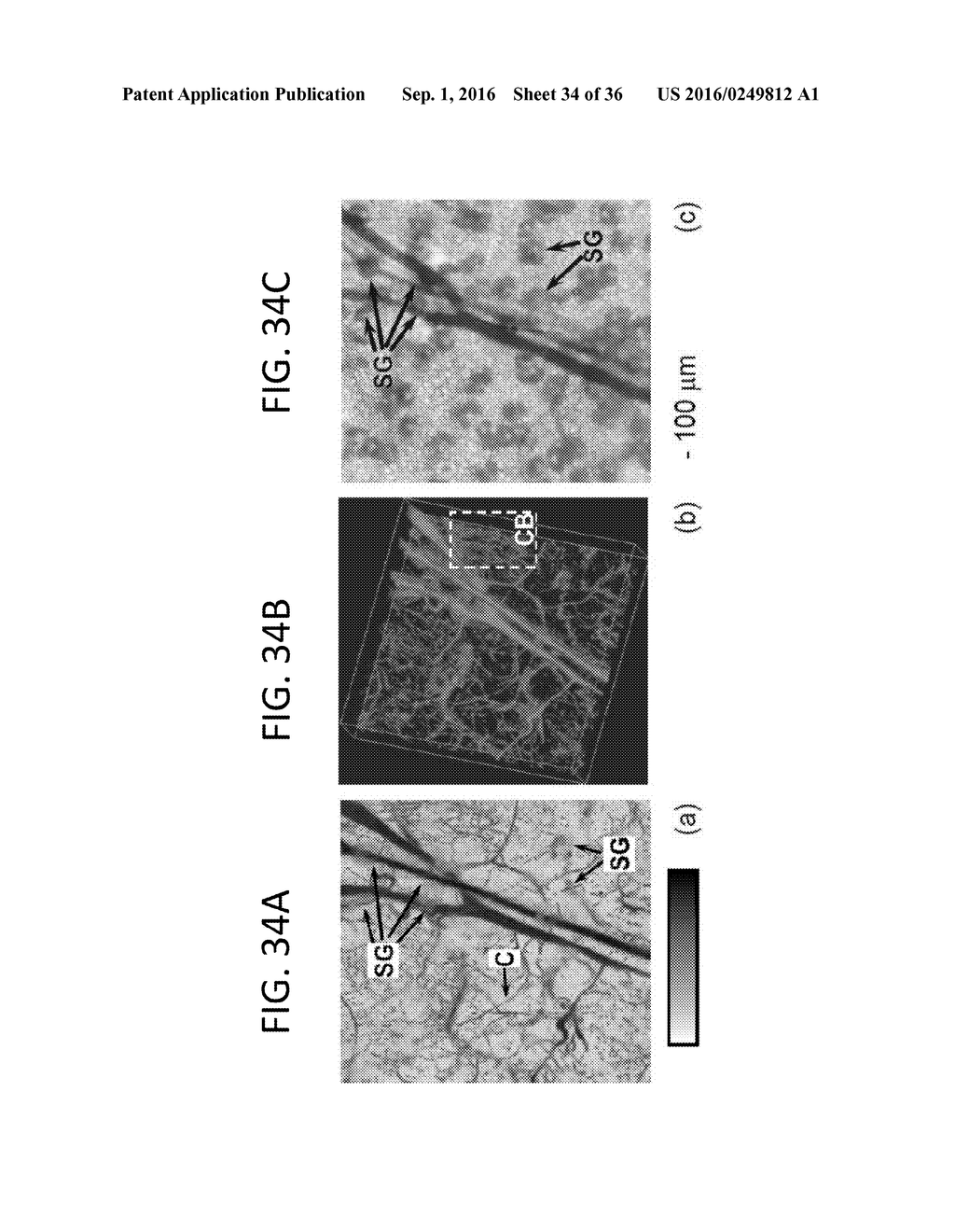 SINGLE-CELL LABEL-FREE PHOTOACOUSTIC FLOWOXIGRAPHY IN VIVO - diagram, schematic, and image 35