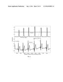 ELECTROCARDIOGRAM SIGNAL DETECTION diagram and image