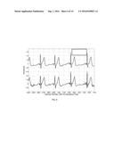 ELECTROCARDIOGRAM SIGNAL DETECTION diagram and image