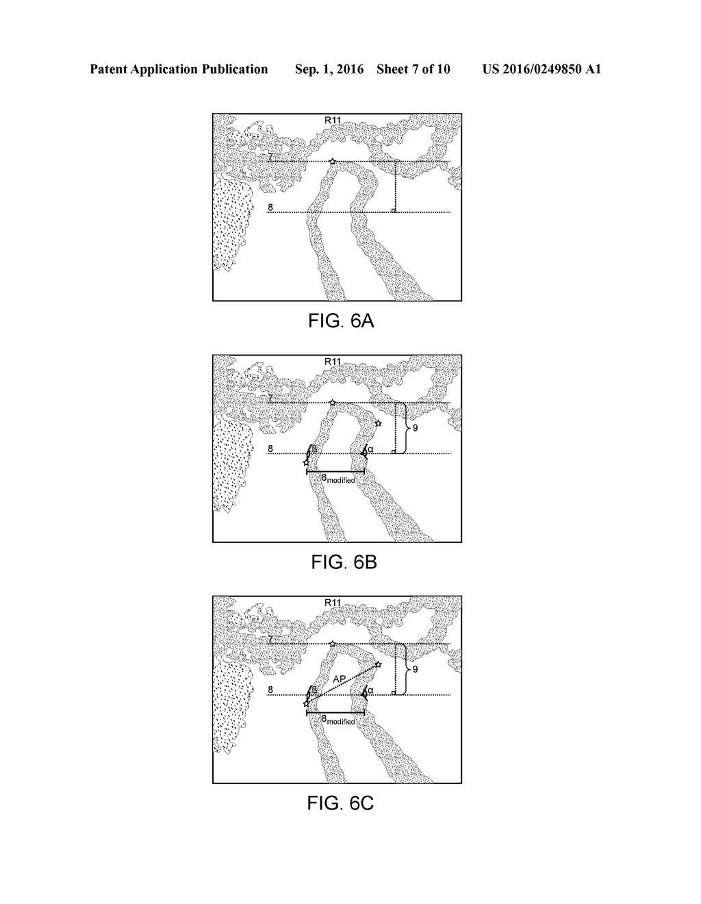 SYSTEM AND METHOD FOR DIAGNOSIS AND ASSESSMENT OF DISC DERANGEMENT     DISORDERS - diagram, schematic, and image 08