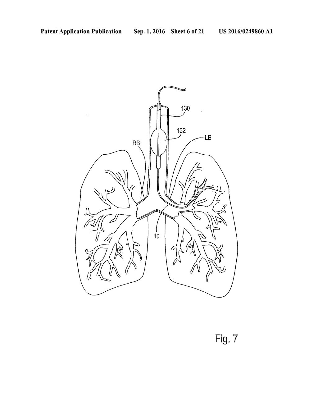 METHOD AND APPARATUS FOR ENDOBRONCHIAL DIAGNOSIS - diagram, schematic, and image 07