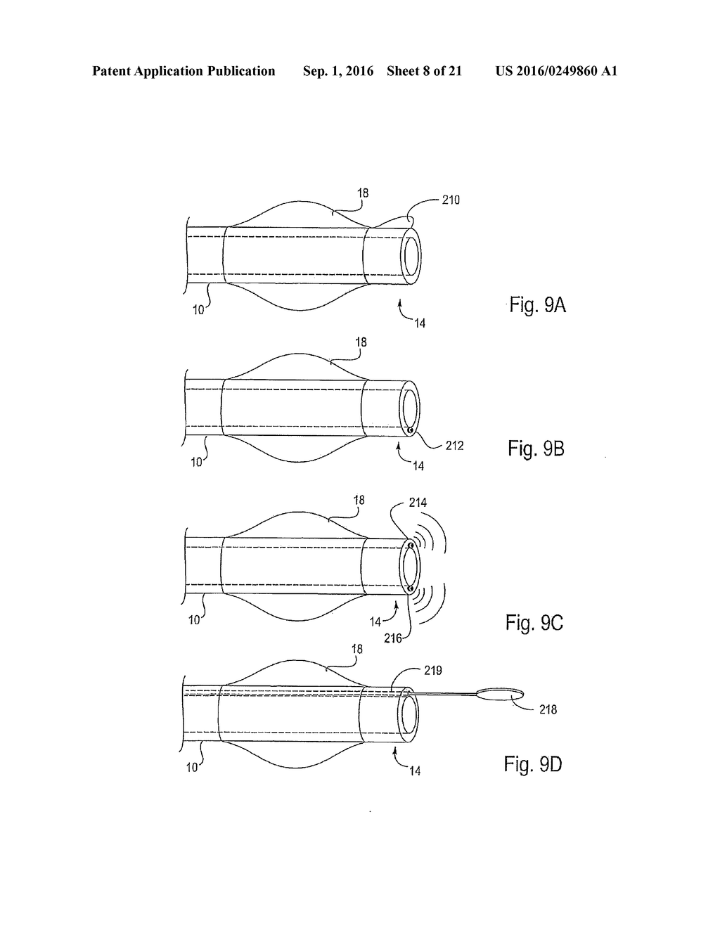 METHOD AND APPARATUS FOR ENDOBRONCHIAL DIAGNOSIS - diagram, schematic, and image 09