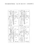 Medical Device Having a Position Indicator diagram and image