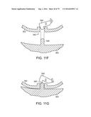 SURGICAL APPARATUS CONFIGURED TO TRACK AN END-OF-LIFE PARAMETER diagram and image