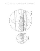 SURGICAL FASTENER APPLYING APPARATUS diagram and image