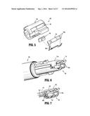 SURGICAL APPARATUS diagram and image