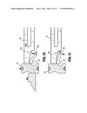 SURGICAL APPARATUS diagram and image