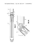 SURGICAL APPARATUS diagram and image