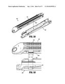 SURGICAL APPARATUS diagram and image