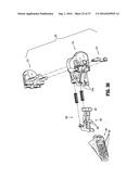 SURGICAL APPARATUS diagram and image