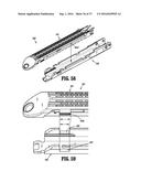 SURGICAL APPARATUS diagram and image