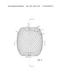 FILAMENTARY DEVICES FOR TREATMENT OF VASCULAR DEFECTS diagram and image