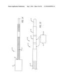 FILAMENTARY DEVICES FOR TREATMENT OF VASCULAR DEFECTS diagram and image