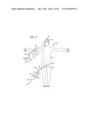 FILAMENTARY DEVICES FOR TREATMENT OF VASCULAR DEFECTS diagram and image