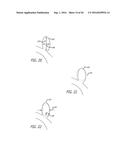 FILAMENTARY DEVICES FOR TREATMENT OF VASCULAR DEFECTS diagram and image