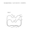 FILAMENTARY DEVICES FOR TREATMENT OF VASCULAR DEFECTS diagram and image