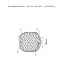 FILAMENTARY DEVICES FOR TREATMENT OF VASCULAR DEFECTS diagram and image