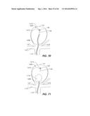 FILAMENTARY DEVICES FOR TREATMENT OF VASCULAR DEFECTS diagram and image