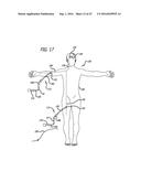 DEVICES FOR THERAPEUTIC VASCULAR PROCEDURES diagram and image