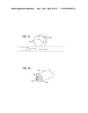 DEVICES FOR THERAPEUTIC VASCULAR PROCEDURES diagram and image