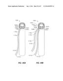 DEVICES FOR THERAPEUTIC VASCULAR PROCEDURES diagram and image