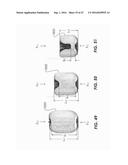 DEVICES FOR THERAPEUTIC VASCULAR PROCEDURES diagram and image