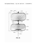 DEVICES FOR THERAPEUTIC VASCULAR PROCEDURES diagram and image